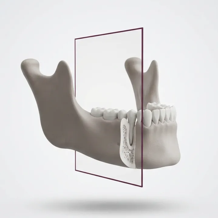 3D-DVT – dreidimensionale Bildgebung